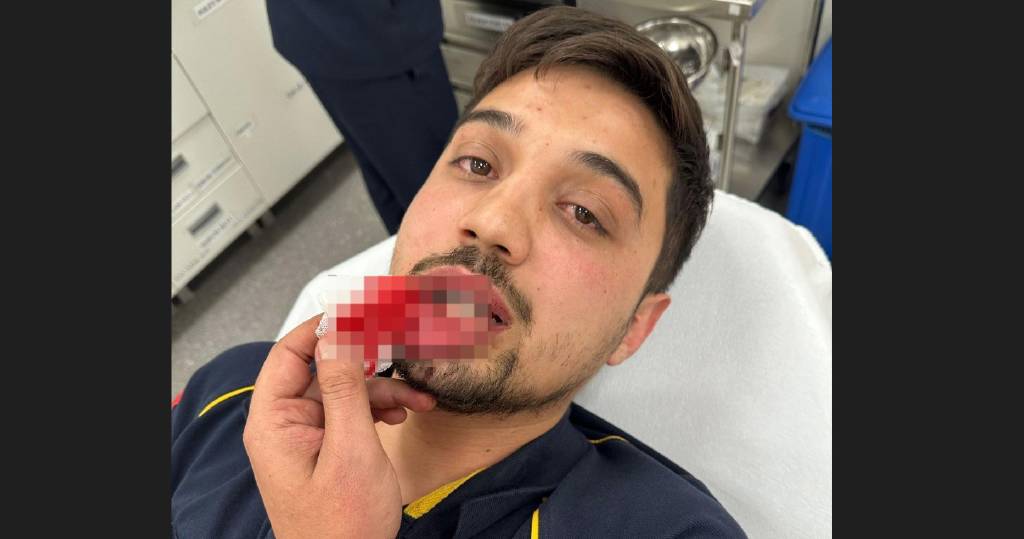 Bursa'da trafik magandaları ambulansın önünü kesti, şoförü darbetti…