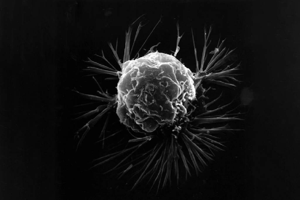 Yeni nesil kanser aşısı, agresif tümörlerin yüzde 88’ine kadarını önleyebiliyor