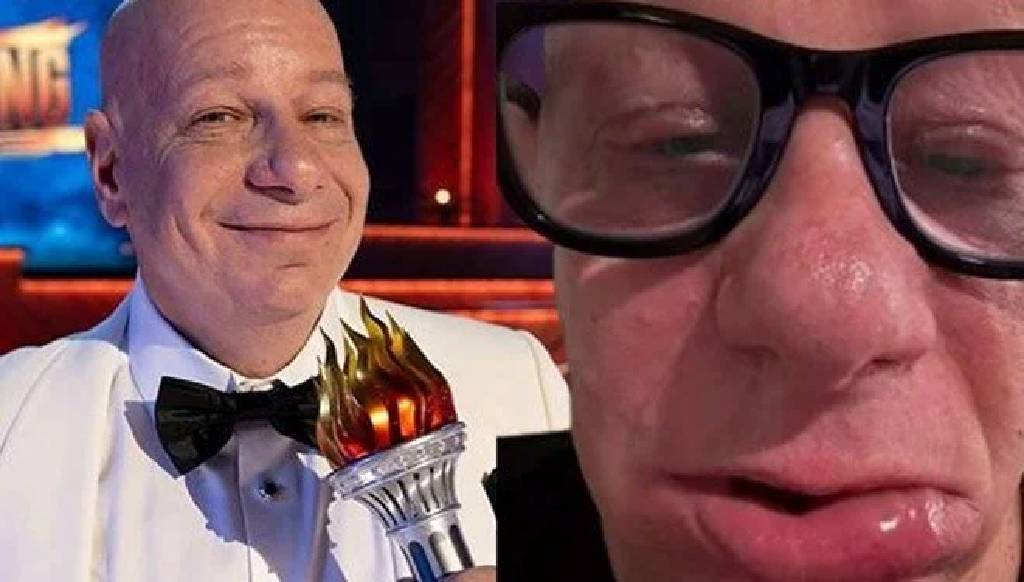 Dondurma yiyen komedyen Jeff Ross'un, dudakları şişti!