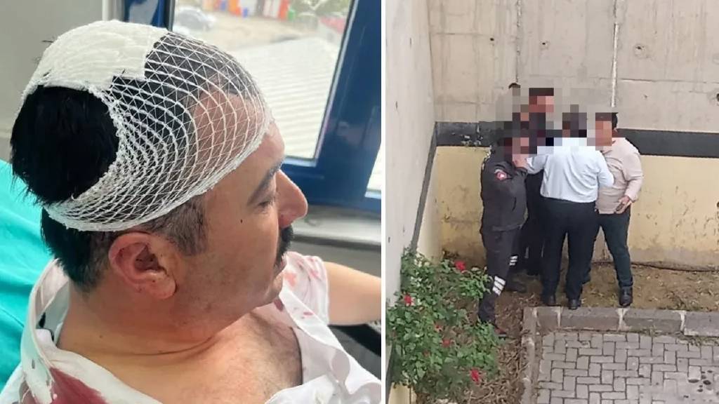Yeniden Refah Partili yönetici Belediye Başkan Yardımcısı'nın kafasına şekerlikle vurdu!