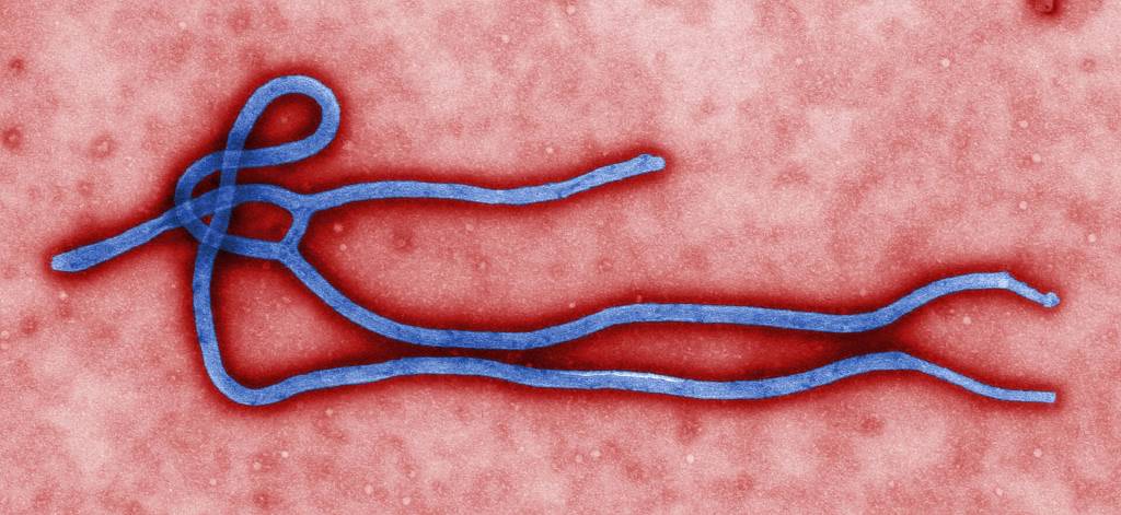 Kongo'daki Ebola salgınında can kaybı 4 bini aştı