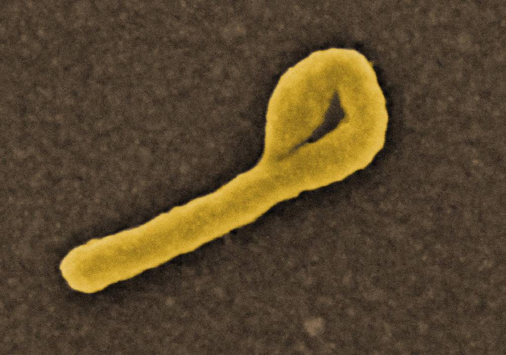 Nijerya, Kenya'daki vakanın ardından Ebola riskine karşı uyardı